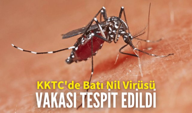 KKTC'de Batı Nil Virüsü vakası tespit edildi