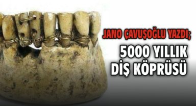 5000 yıllık Diş Köprüsü