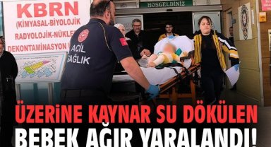 Üzerine kaynar su dökülen bebek ağır yaralandı!